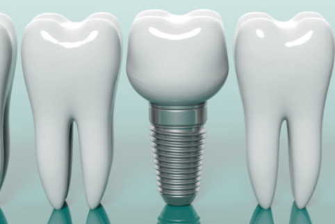 入れ歯の使い心地にお悩みの方もご相談ください