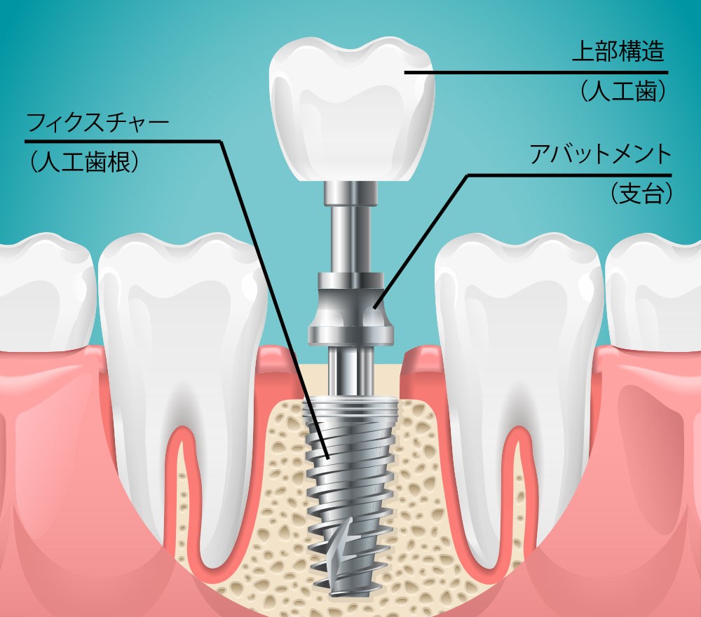 ※画像はイメージです。