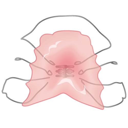 ライフスタイルに合う矯正提案