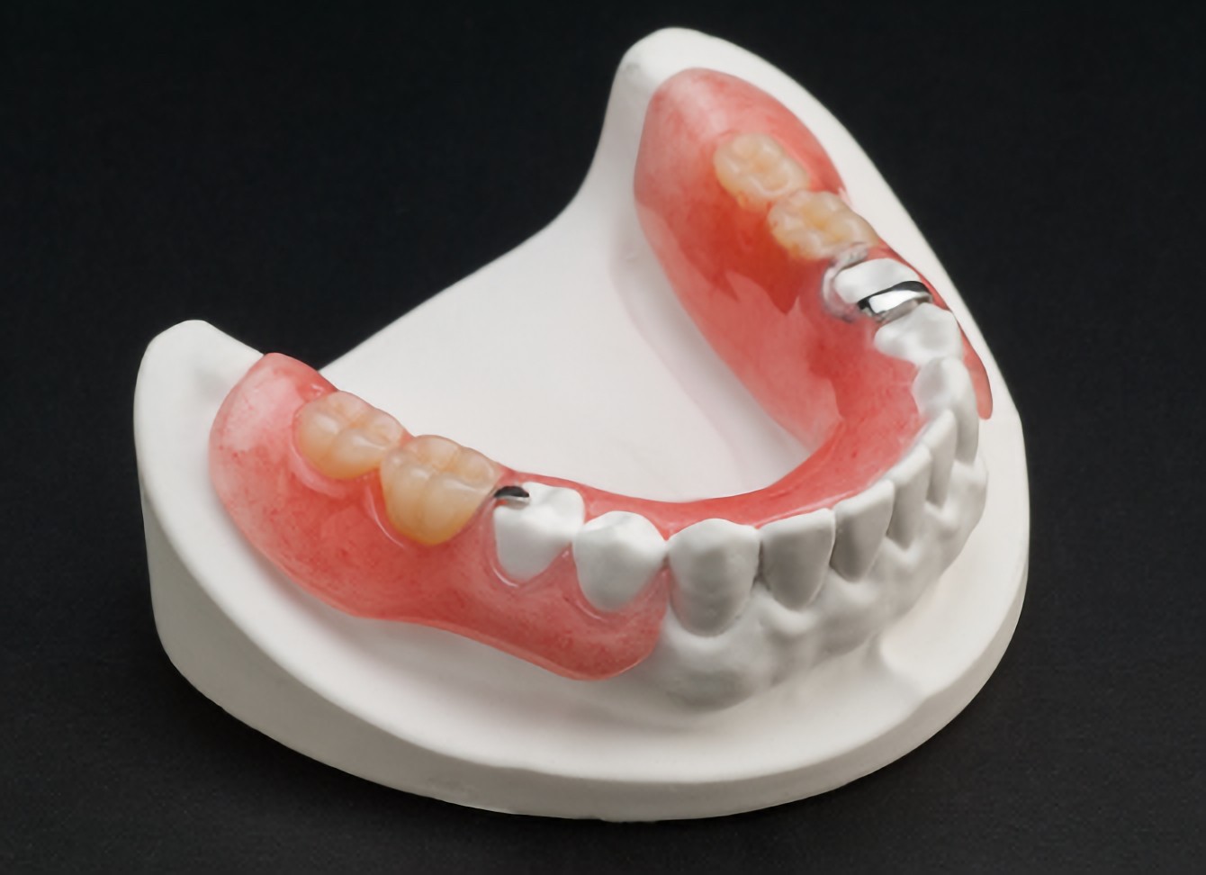 様々な入れ歯を取り扱っています