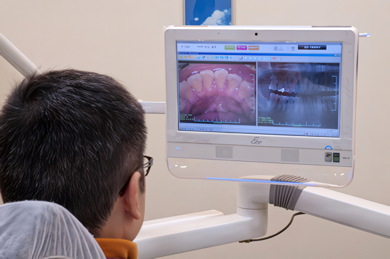 安全で殺菌力の高い炭酸ガスレーザー（クラス4レーザー）を導入しています