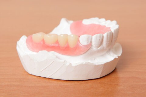 歯科技工士が優れた義歯をご用意いたします