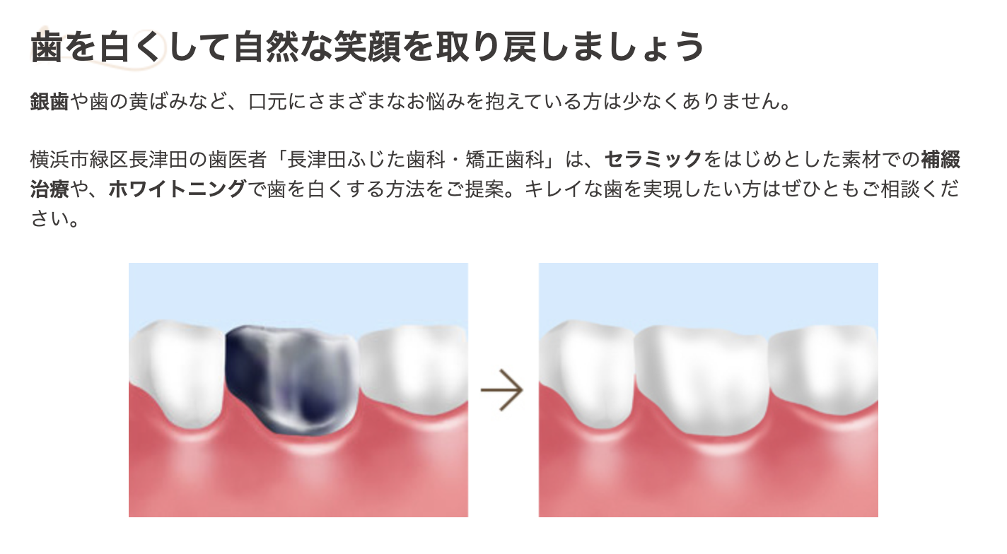 審美治療とホワイトニングでは口元のお悩みを解消し、美しい笑顔をサポートしています
