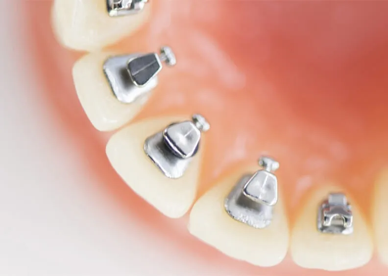 目立ちにくい矯正治療を希望される患者様にも、審美性と機能性の両立を図った診療体制が提供されています