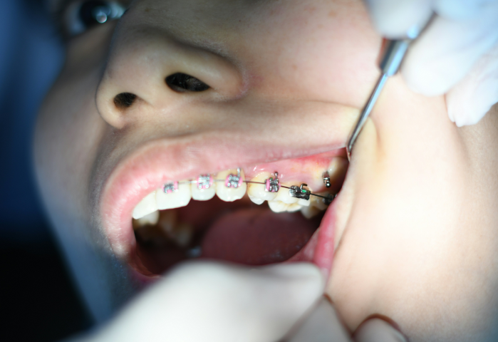 歯を削らず守る歯科医院でありたいと考えています。