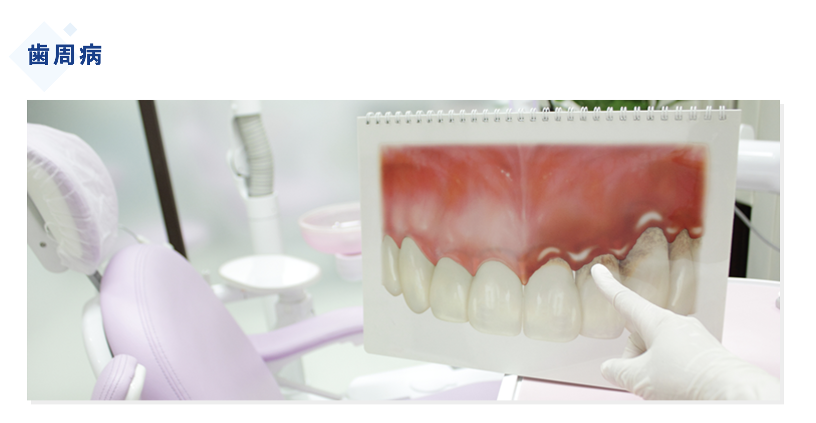 毎日のケアと定期的な歯科受診で、健康な歯ぐきを保つことができます