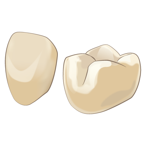 クラウン（被せ物）