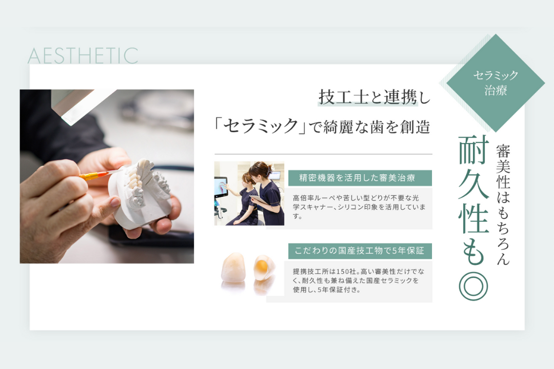 セラミック治療の特徴