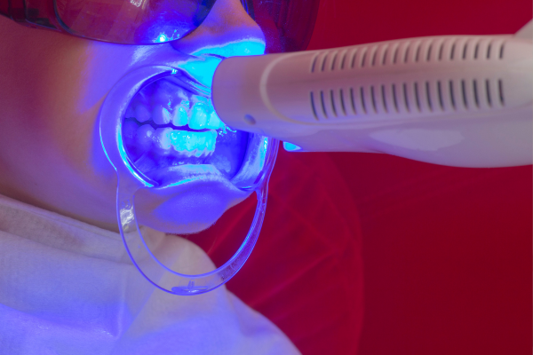 ※画像はイメージです