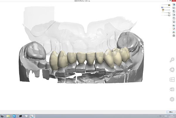 シミュレーションソフトと使用して治療を行います