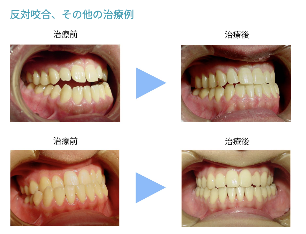 自然な顎の動きが取り戻せるよう治療を進めています