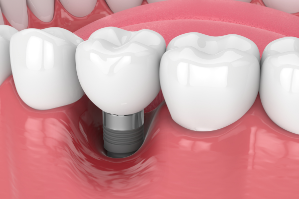 ※画像はイメージです