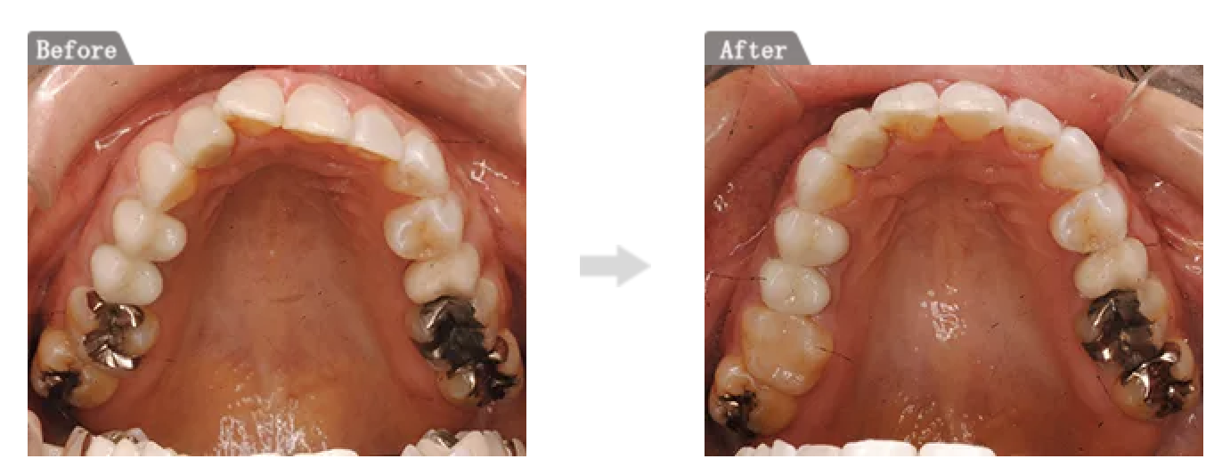 部分矯正も可能です