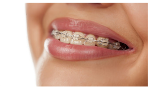 歯並びのお悩みはございませんか