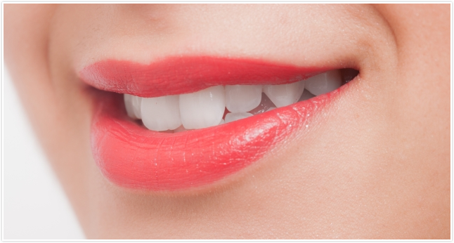 ホワイトニング