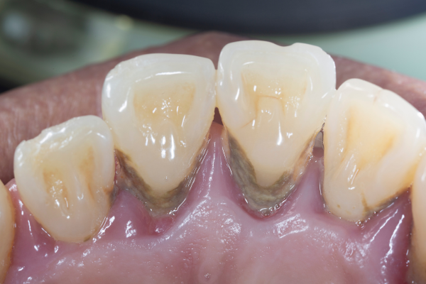 ※画像はイメージです