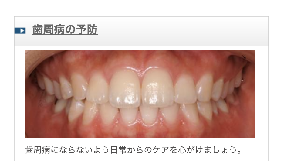 歯周病の予防には、歯垢（プラーク）の増殖を抑える「プラークコントロール」が重要です