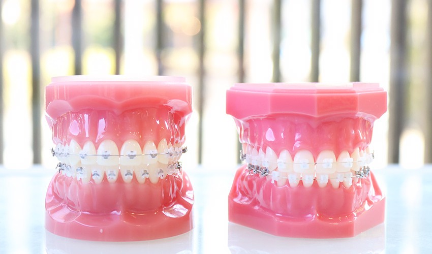 矯正治療は期間を要することが多いため、継続しやすい環境づくりも重視しています。