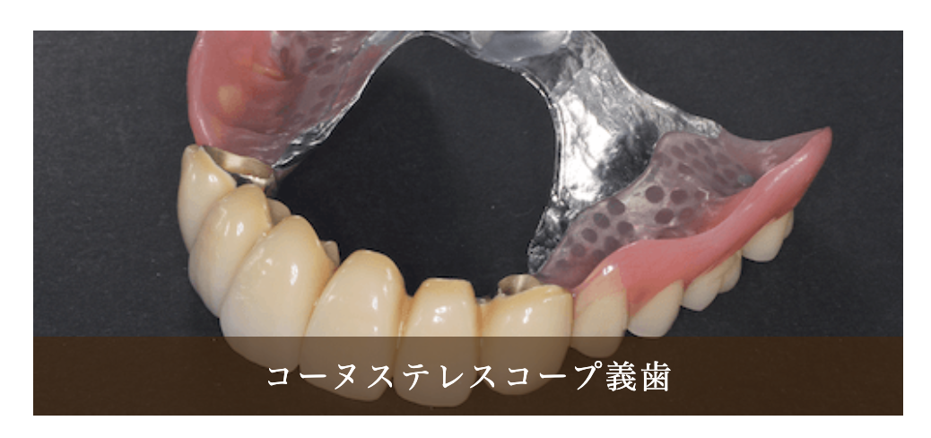 義歯（入れ歯）治療を通じて、しっかりと噛める快適な口腔環境を提供しています