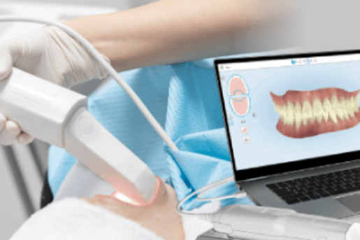 口腔内スキャン