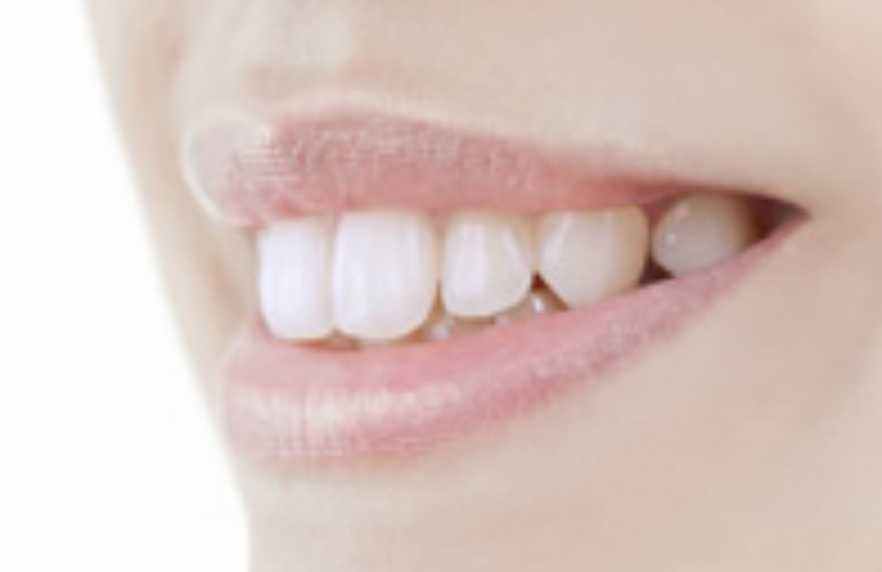 天然歯のような美しさと機能性を兼ね備えた審美歯科治療をご提供