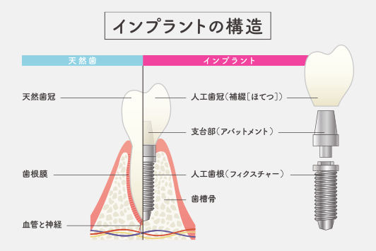 あなたの噛み心地と美しさを取り戻すお手伝いを全力でサポートいたします