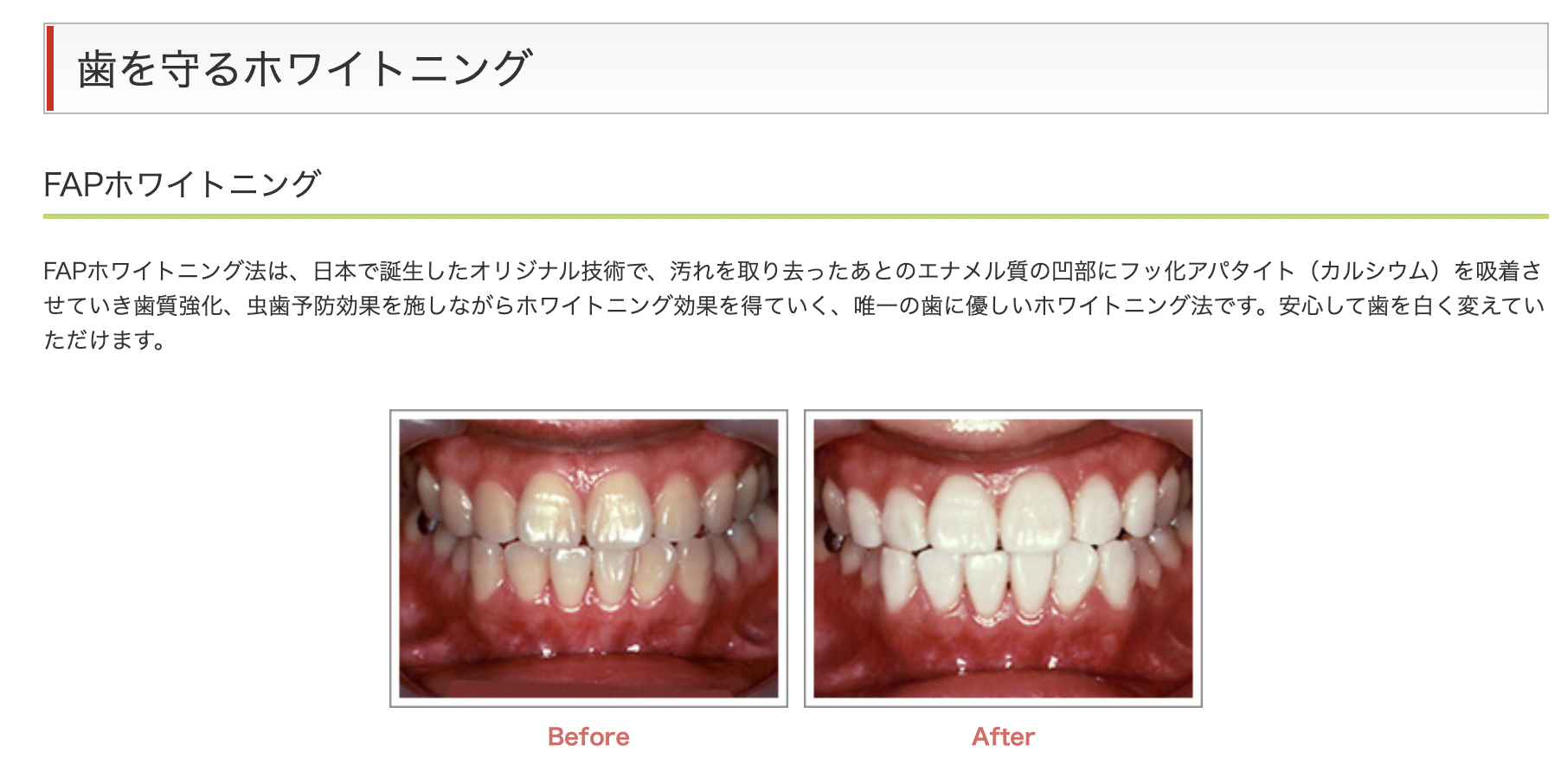 歯の美しさと健康を両立させるホワイトニングを提供しています
