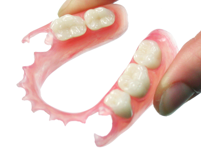 ノンクラスプデンチャー