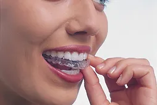 矯正に関する相談は無料です