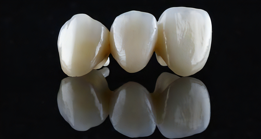 審美歯科治療を提供