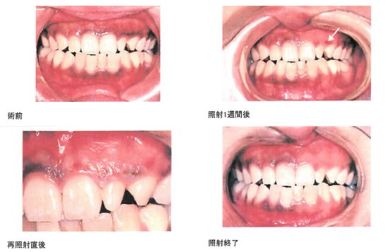 患者様のご希望に合わせた自然な白い歯を提供しています