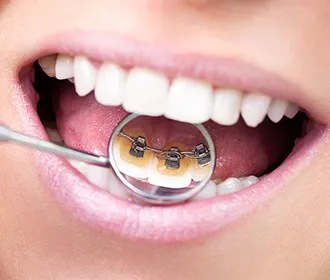 矯正治療に不安を抱える患者様にも、丁寧な説明と対応で安心感を提供しています