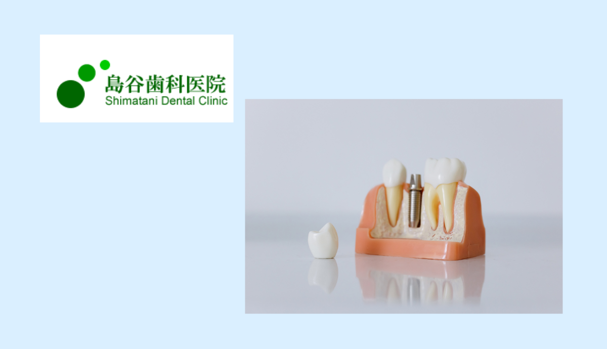 ミニインプラントによる快適な入れ歯固定