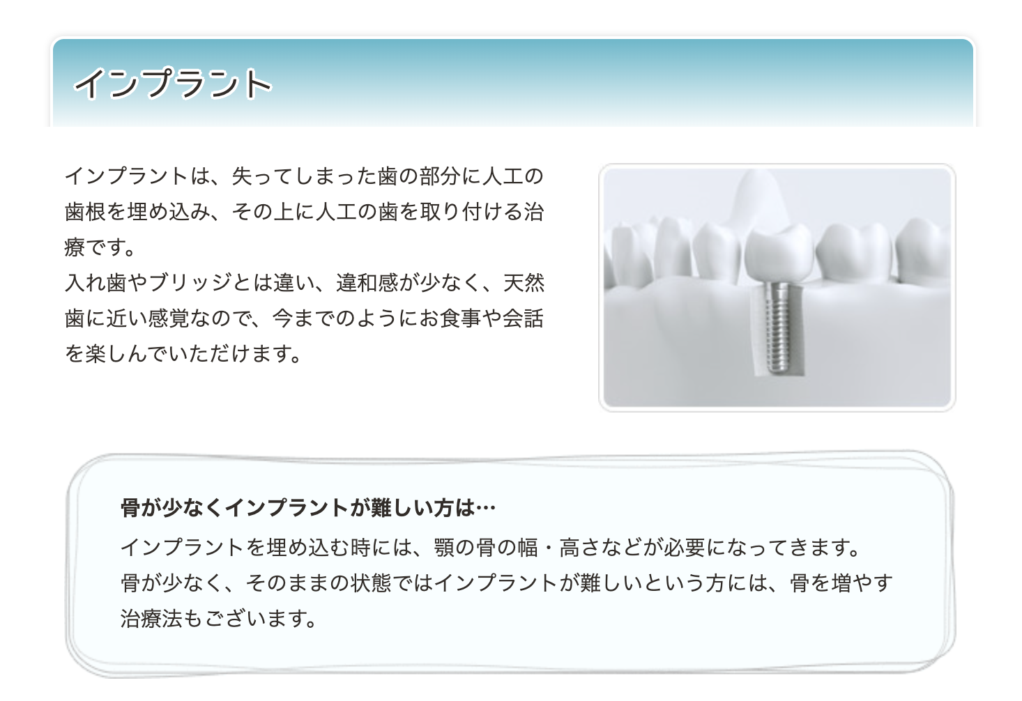 天然歯に近い感覚で会話や食事を楽しむことができます
