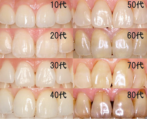 エナメル質が歯の見た目のほとんどを占めています