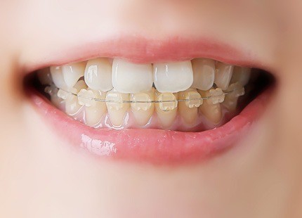 機能と審美の両立を図る治療を通じて、患者様が自信をもって笑顔になれる口腔環境づくりを支えています。