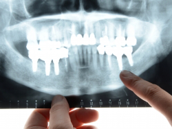 患者様のお口の状態や生活背景、ご希望を丁寧に確認しながら、無理のない治療計画を提案しています。