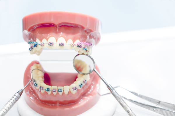 ※画像はイメージです