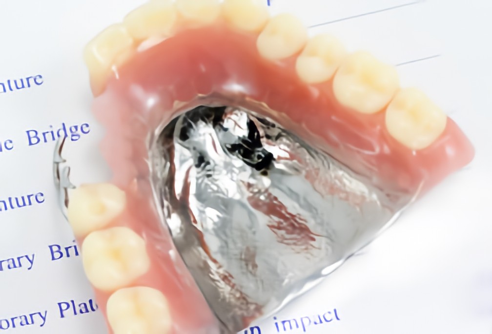 最適な入れ歯をご提案します