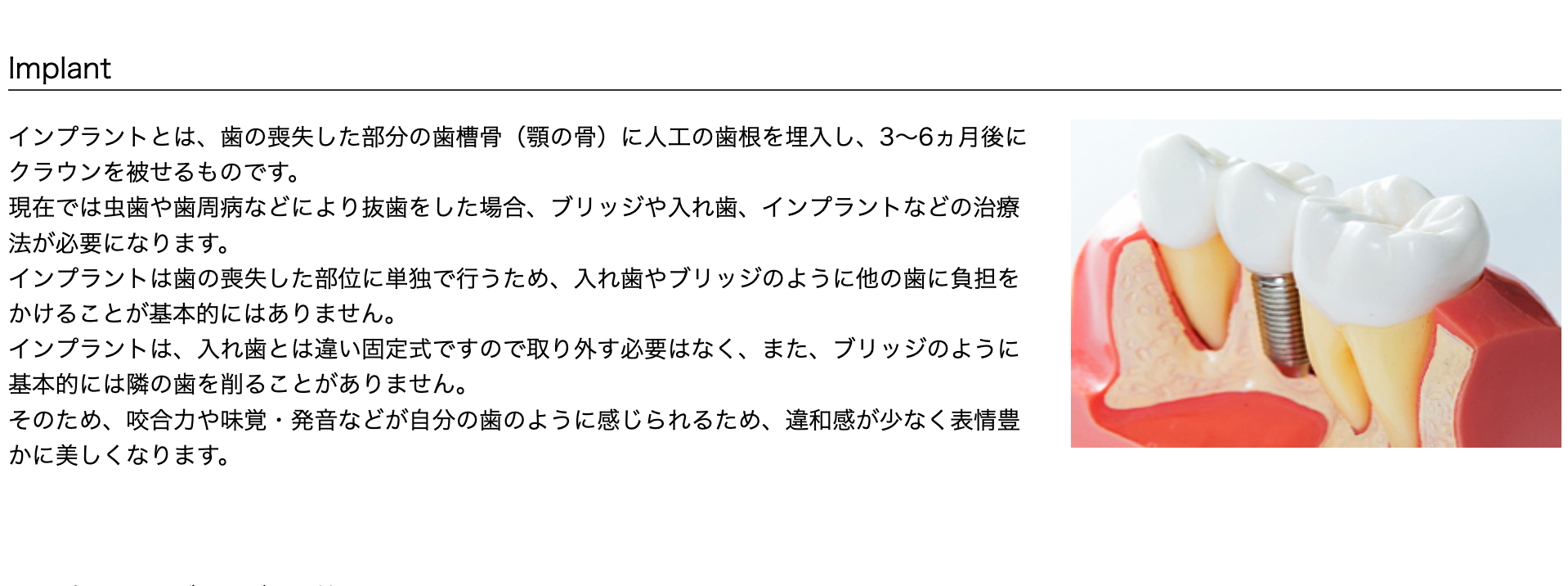 より自然な形で口腔機能を回復させることが可能です