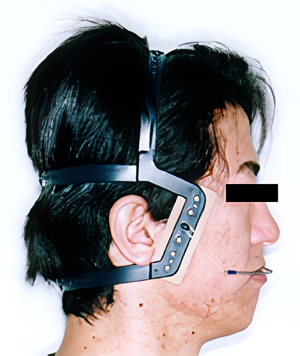 見た目の美しさと同時に、機能性を重視した噛み合わせ治療を大切にしています。