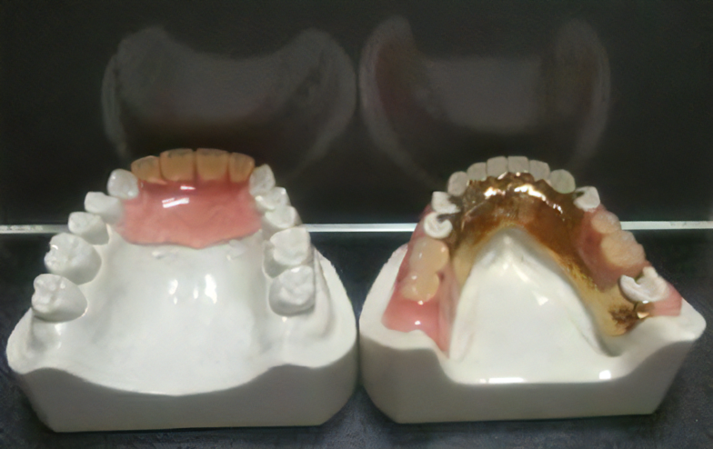 有床義歯治療を提供