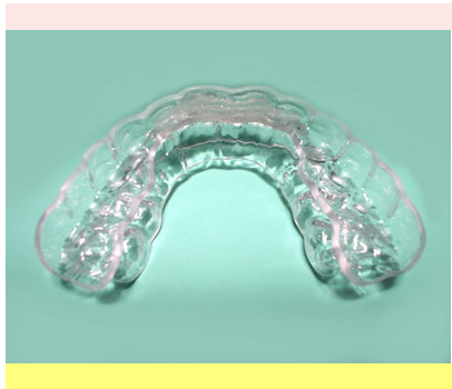 患者様に適したスリープスプリント療法を提案しています