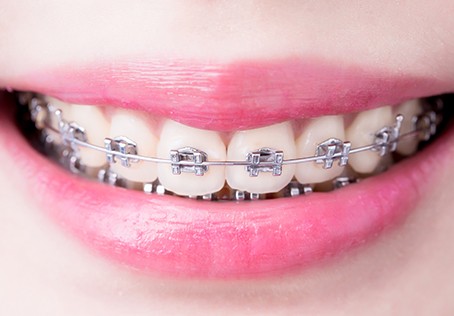 ※画像はイメージです。