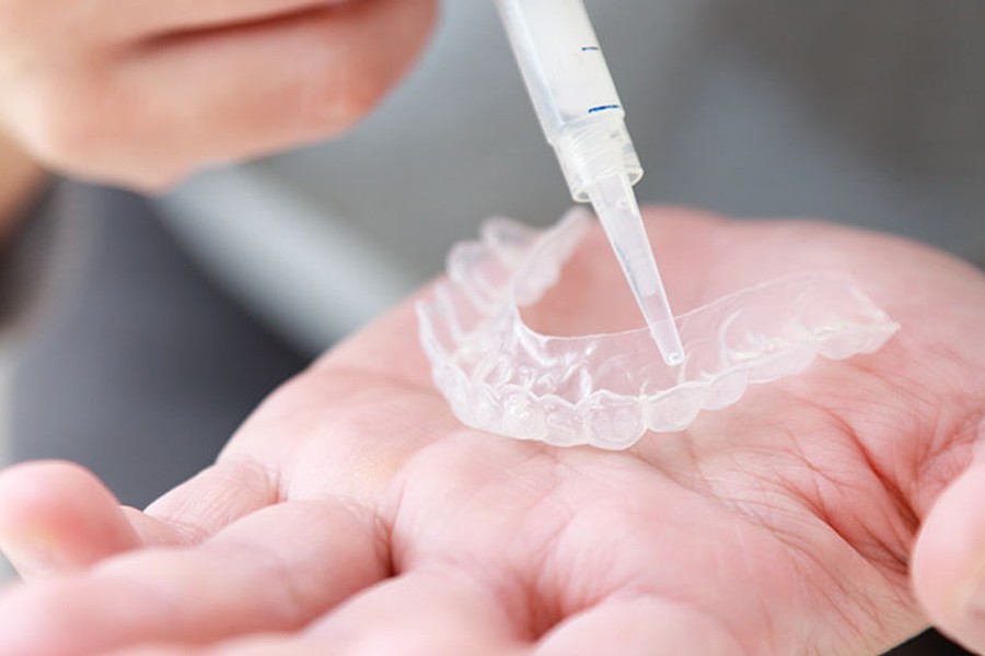 ホームホワイトニングを取り扱っています