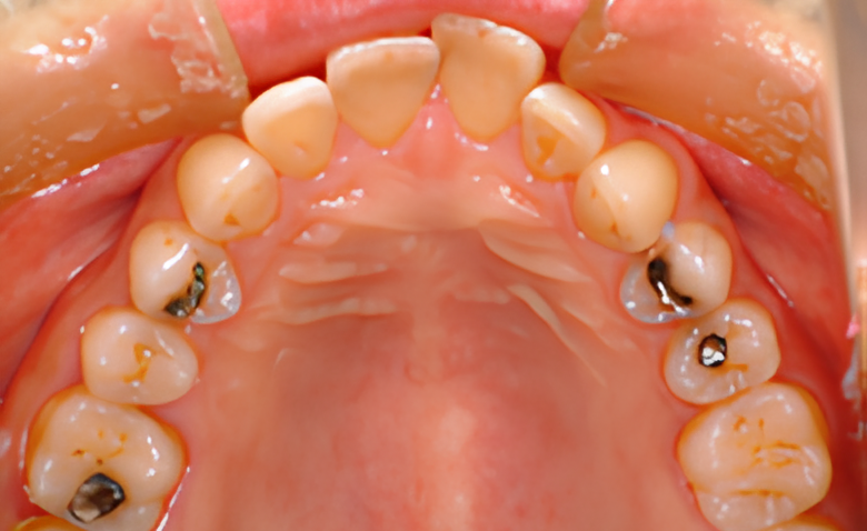 最新機器を用いた精密検査と低侵襲治療で歯周病の進行を効果的に防止
