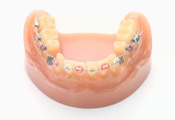 確かな技術と丁寧な対応により、自然で美しい歯並びへ導く矯正治療を提供しています。