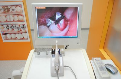 モニターにて口内の様子を確認できます