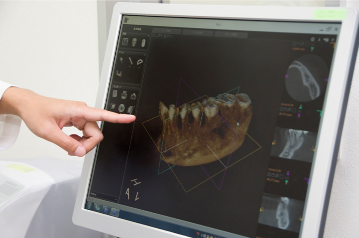 予防と保存を重視した治療で、生涯の歯の健康をサポートします