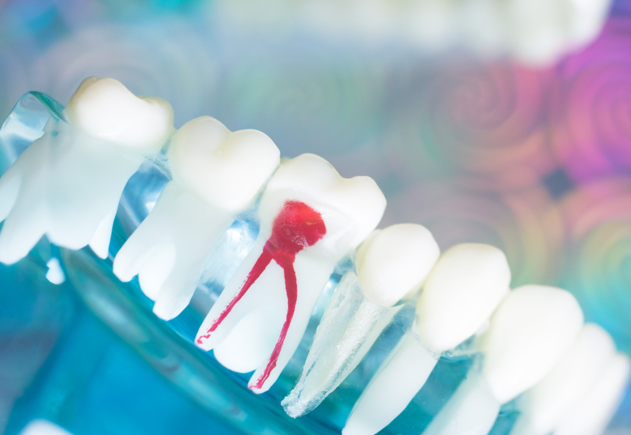 3D診断と高度な技術で、諦めかけた歯も可能な限り保存します